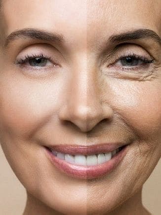 Chống Lão Hóa Da Vùng Mắt: Quầng Thâm, Nếp Nhăn, Da Chùng